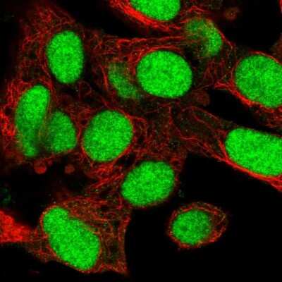 Immunocytochemistry/ Immunofluorescence: KIN Antibody [NBP2-58750]