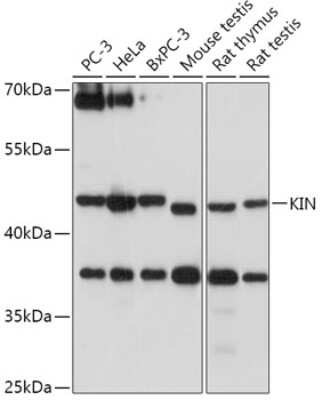 Western Blot: KIN AntibodyAzide and BSA Free [NBP3-04797]