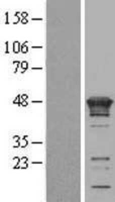 Western Blot: KIN Overexpression Lysate [NBL1-12300]