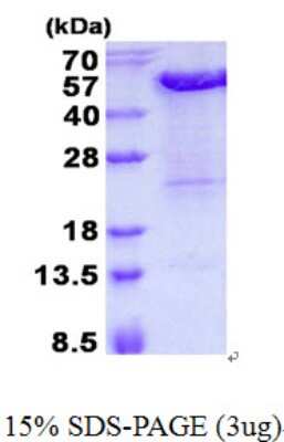 SDS-PAGE: Recombinant Human KIN His Protein [NBP2-23174]