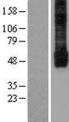 Western Blot: KIR2.3 Overexpression Lysate [NBL1-12171]