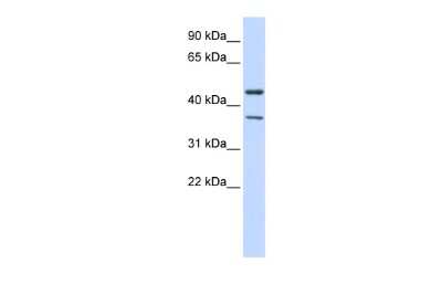 Western Blot: KIR2.3 Antibody [NBP2-84118]