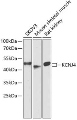 Western Blot: KIR2.3 AntibodyBSA Free [NBP3-03005]