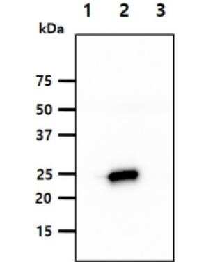 Western Blot: KIR2DL3/CD158b2 Antibody (190IIC311)BSA Free [NBP1-04316]