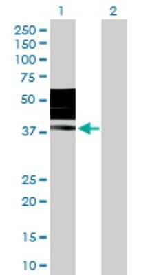 Western Blot: KIR2DL3/CD158b2 Antibody [H00003804-D01P]