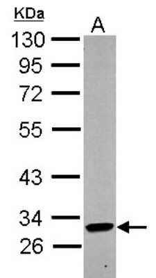 Western Blot: KIR2DL4/CD158d Antibody [NBP2-17062]