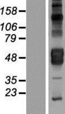 Western Blot: KIR2DL4/CD158d Overexpression Lysate [NBL1-12302]