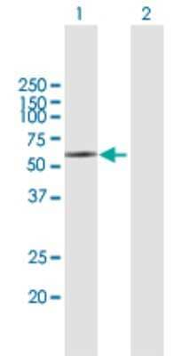 Western Blot: KIR2DL5/CD158f Antibody [H00057292-B01P]