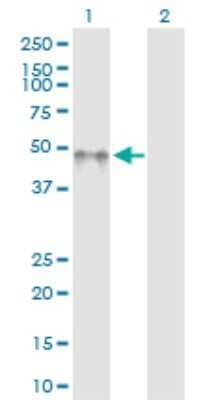 Western Blot: KIR2DL5/CD158f Antibody [H00057292-D01P]