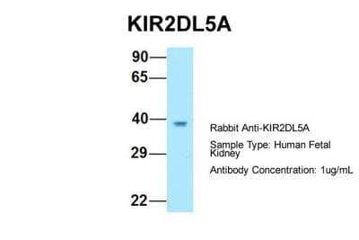 Western Blot: KIR2DL5/CD158f Antibody [NBP2-82265]