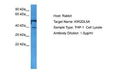 Western Blot: KIR2DL5/CD158f Antibody [NBP2-82266]