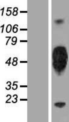 Western Blot: KIR2DL5/CD158f Overexpression Lysate [NBP2-06630]