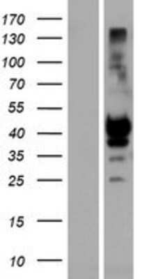 Western Blot: KIR2DS1/CD158h Overexpression Lysate [NBP2-07321]