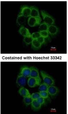 Immunocytochemistry/ Immunofluorescence: KIR2DS2 Antibody [NBP2-15005]
