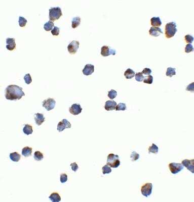 Immunocytochemistry/ Immunofluorescence: KIR2DS2 Antibody - BSA Free [NBP2-82102]