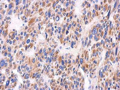 Immunohistochemistry-Paraffin: KIR2DS2 Antibody [NBP2-15004]