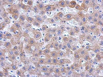 Immunohistochemistry-Paraffin: KIR2DS2 Antibody [NBP2-15005]