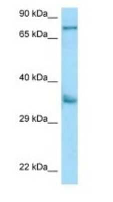 Western Blot: KIR2DS2 Antibody [NBP1-98548]