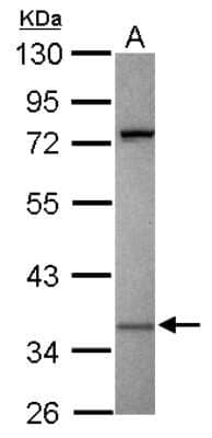 Western Blot: KIR2DS2 Antibody [NBP2-15004]