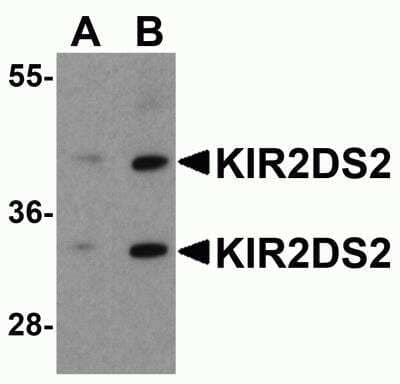 Western Blot: KIR2DS2 AntibodyBSA Free [NBP2-82102]