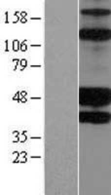 Western Blot: KIR2DS2 Overexpression Lysate [NBP2-07460]