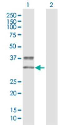 Western Blot: KIR2DS3 Antibody [H00003808-D01P]