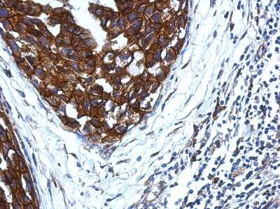 Immunohistochemistry-Paraffin: KIR2DS4/CD158i Antibody [NBP2-15006]