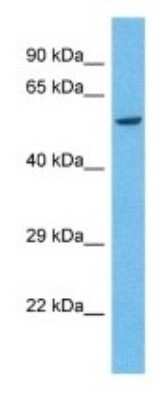 Western Blot: KIR2DS4/CD158i Antibody [NBP3-09976]