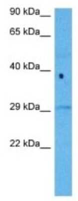 Western Blot: KIR2DS4/CD158i Antibody [NBP3-10034]