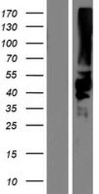 Western Blot: KIR2DS5/CD158g Overexpression Lysate [NBP2-07322]