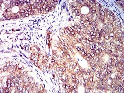 Immunohistochemistry: KIR3DL1 Antibody (2C3B6) - BSA Free [NBP2-61687]