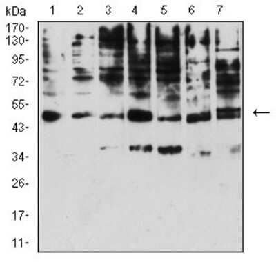 Western Blot: KIR3DL1 Antibody (6D9A4)BSA Free [NBP2-61805]