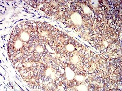 Immunohistochemistry: KIR3DL1 Antibody (6D9F6) - BSA Free [NBP2-61811]
