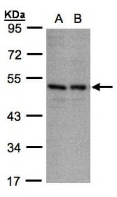 Western Blot: KIR3DL1 Antibody [NBP1-31609]