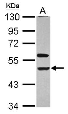 Western Blot: KIR3DL1 Antibody [NBP2-17063]