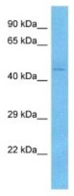 Western Blot: KIR3DL2/CD158k Antibody [NBP3-09977]