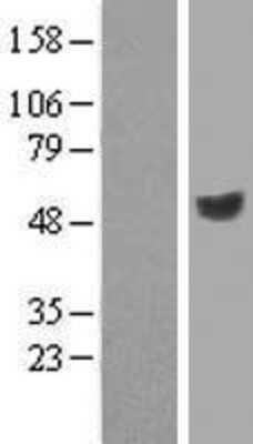 Western Blot: KIR3DL2/CD158k Overexpression Lysate [NBP2-07588]