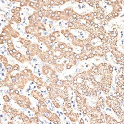 Immunohistochemistry-Paraffin: KIR3DS1/CD158e2 Antibody - BSA Free [NBP3-03813]