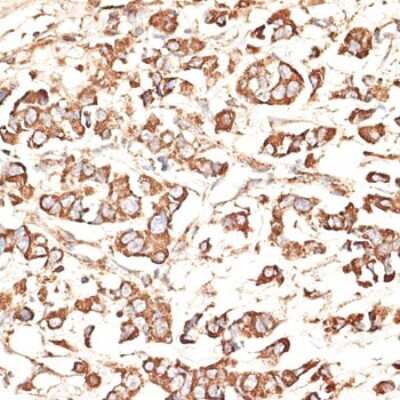 Immunohistochemistry-Paraffin: KIR3DS1/CD158e2 Antibody - BSA Free [NBP3-03813]