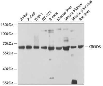 Western Blot: KIR3DS1/CD158e2 AntibodyBSA Free [NBP3-03813]