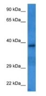 Western Blot: KIR3DS1/CD158e2 Antibody [NBP3-09424]