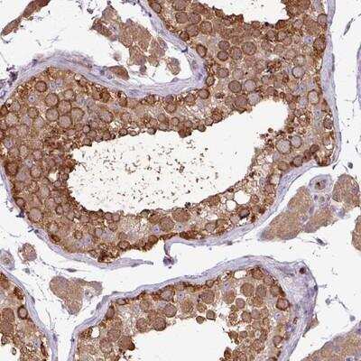 Immunohistochemistry-Paraffin: KIR3DX1 Antibody [NBP2-14160]