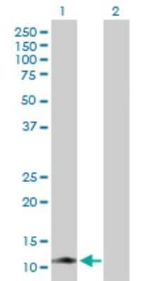 Western Blot: KIR3DX1 Antibody [H00090011-B01P]