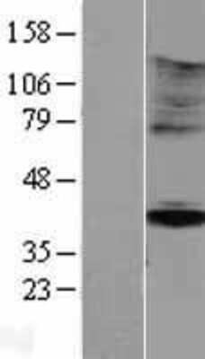 Western Blot: KIR5.1 Overexpression Lysate [NBP2-05200]