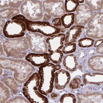 Immunohistochemistry-Paraffin: KIR5.1 Antibody [NBP2-34127]