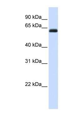 Western Blot: Kirrel2/NEPH3 Antibody [NBP1-59231]