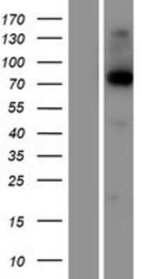 Western Blot: Kirrel2/NEPH3 Overexpression Lysate [NBP2-04648]