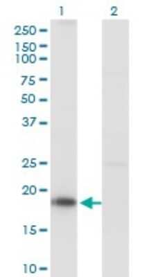 Western Blot: KISS1 Antibody (1D11) [H00003814-M03]