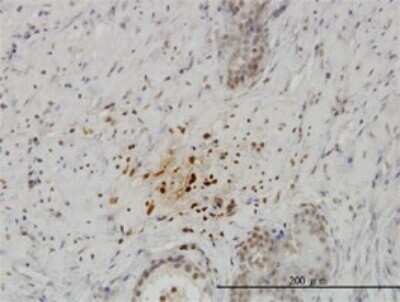 Immunohistochemistry-Paraffin: KISS1 Antibody (1F7) [H00003814-M05]