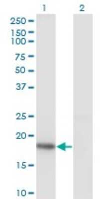 Western Blot: KISS1 Antibody (1F7) [H00003814-M05]